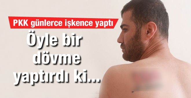 Öyle bir dövme yaptırdı ki... PKK günlerce işkence yaptı